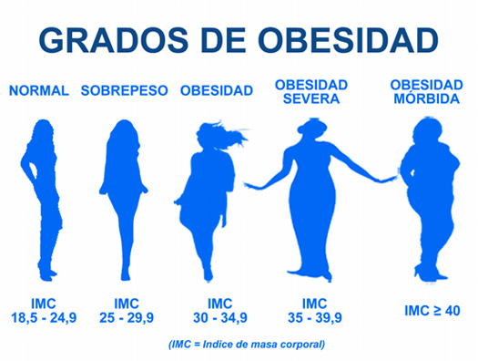 grados de obesidad operación reducción de estómago