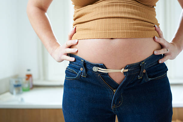 reducción de estómago antes y después obesidad mujer
