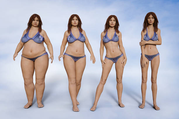 ilustración 3D antes y después operación reducción estómago