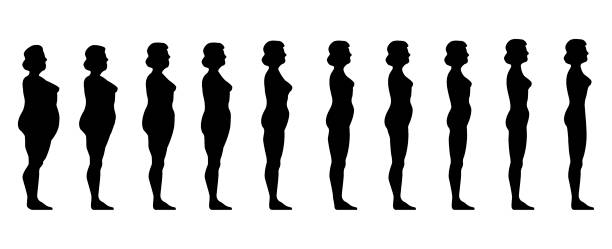 evolución antes y después de operación reducción de estómago