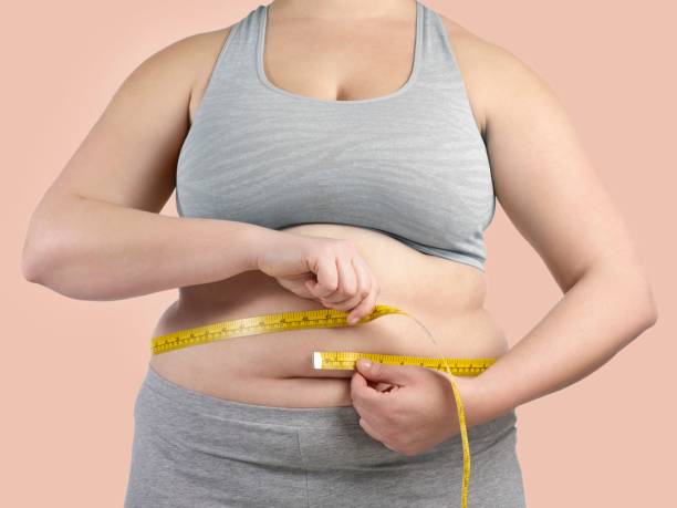reducción de estómago riesgos reincidir obesidad